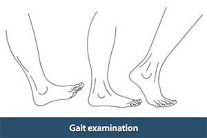 Gait Knee Exam